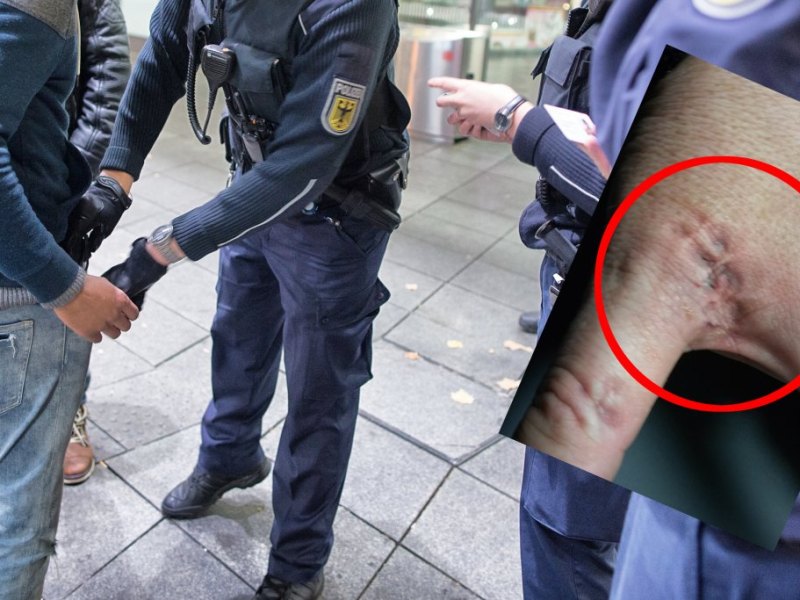 Bisswunde Hauptbahnhof Essen Bundespolizei.jpg