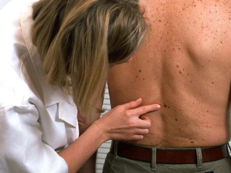 Krankenkasse AOK beklagt sich über Hautärzte